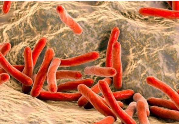 Ce este lepra, cum se manifestă şi cum se tratează lepra